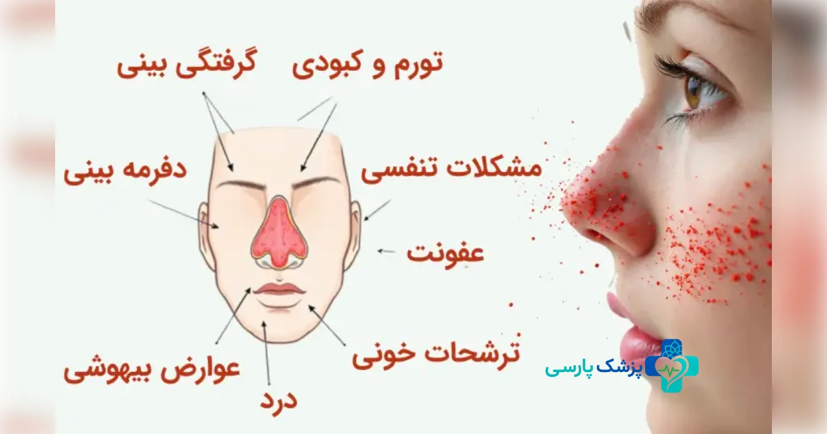 عوارض عمل جراحی بینی