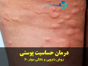 درمان حساسیت پوستی