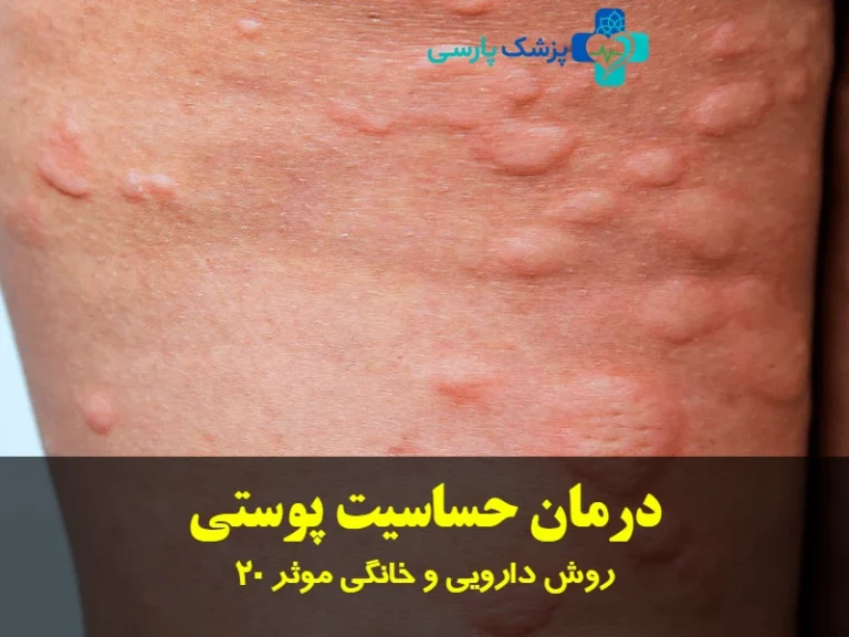 درمان حساسیت پوستی