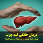 درمان خانگی کبد چرب