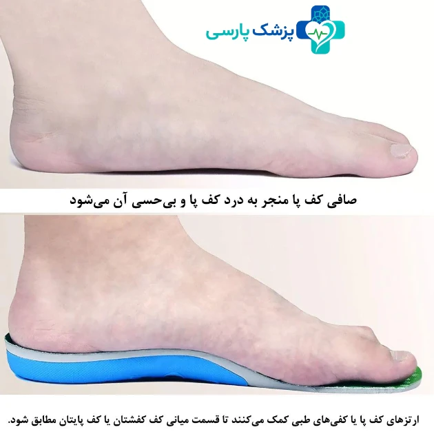 عمل کف پای صاف