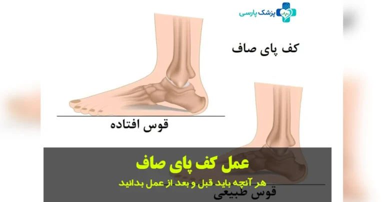 عمل کف پای صاف