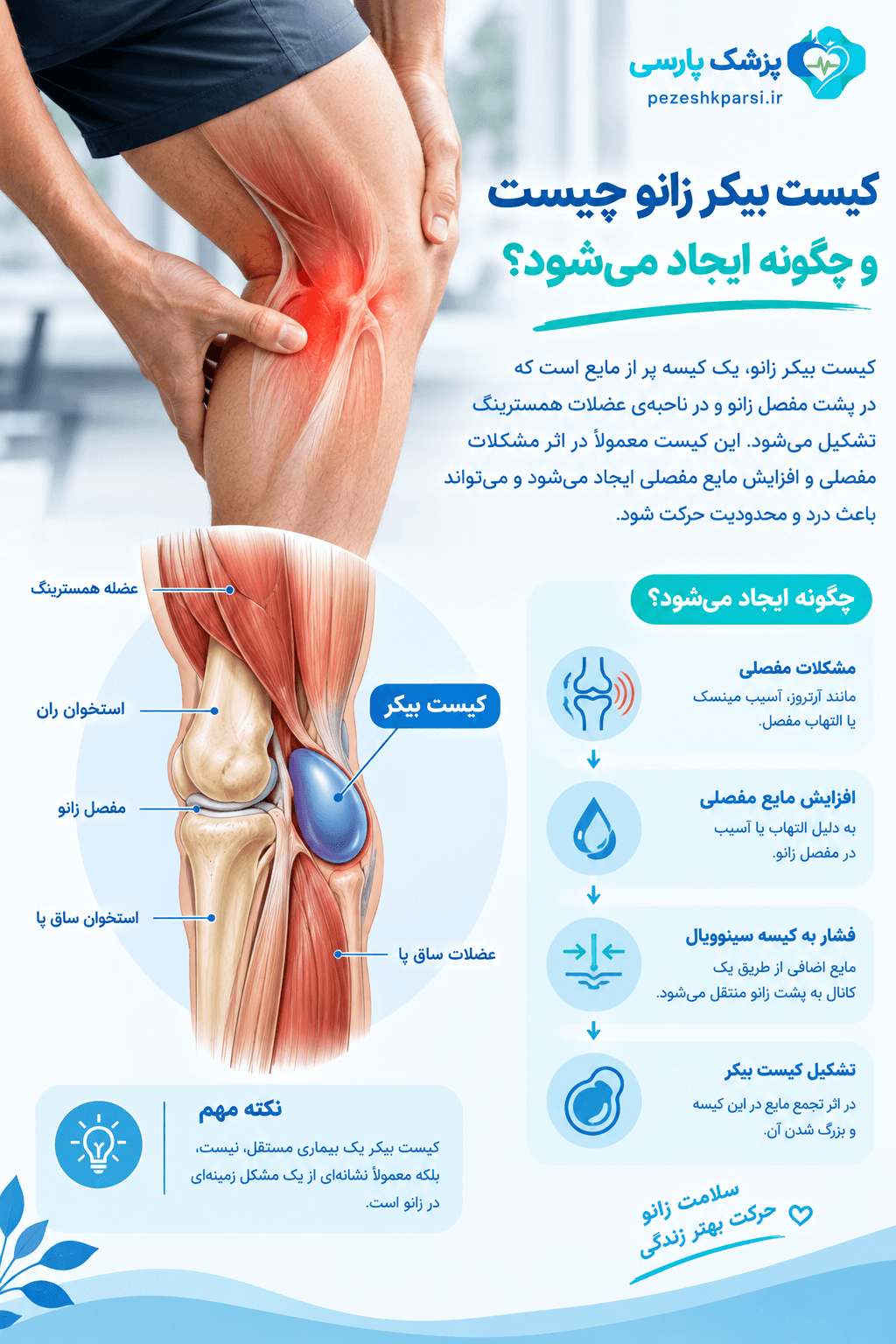 کیست بیکر زانو چیست و چگونه ایجاد میشود
