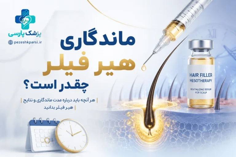 ماندگاری هیر فیلر چقدر است