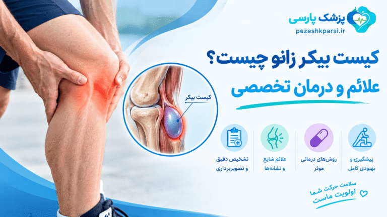 کیست بیکر زانو چیست؟ علائم و درمان تخصصی